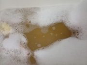 Blace: Tamnožuta voda ponovo iz slavina, građani bez zvaničnog objašnjenja